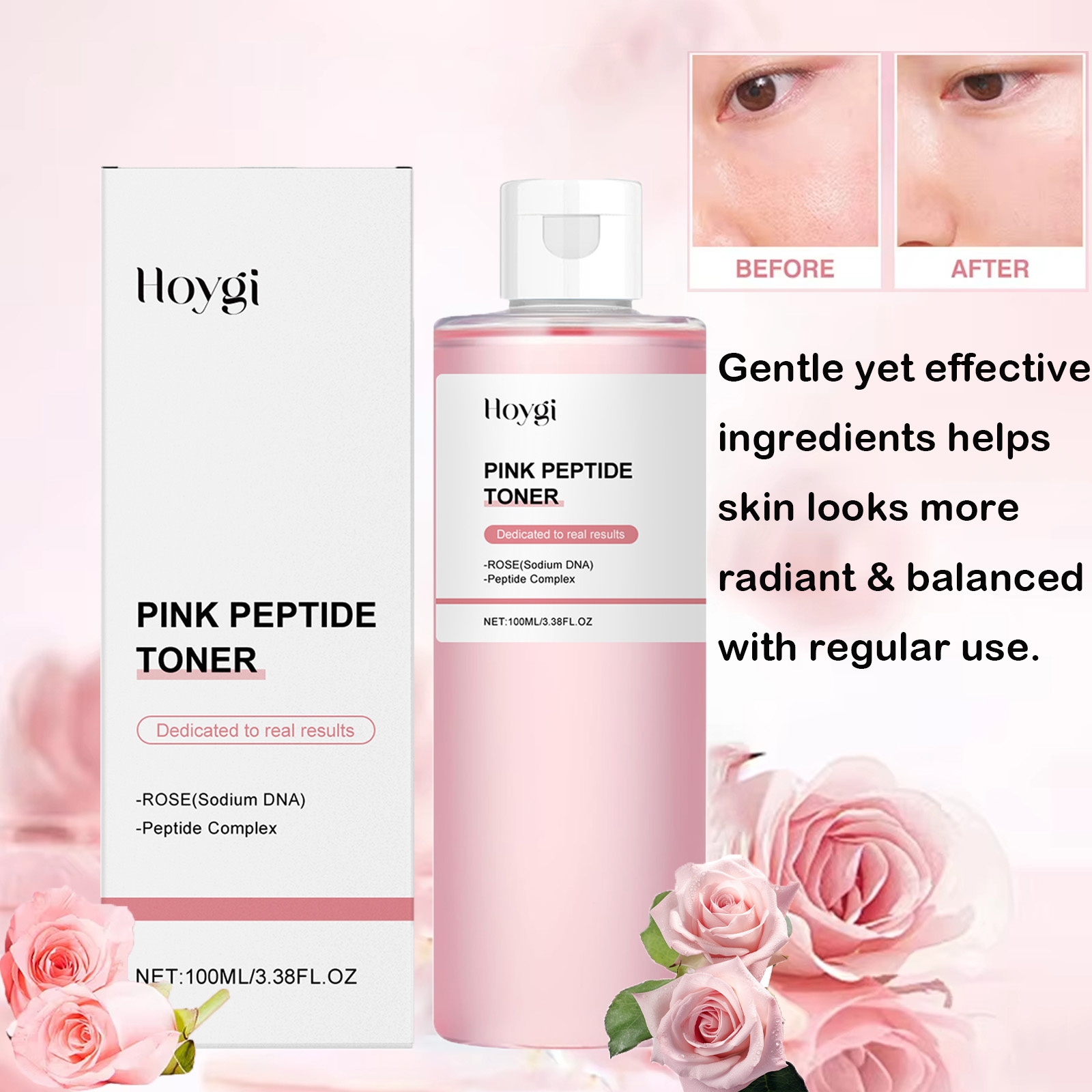 Rose Essence Toner Glowing Ski - đánh giá và giá Rose Water Spray